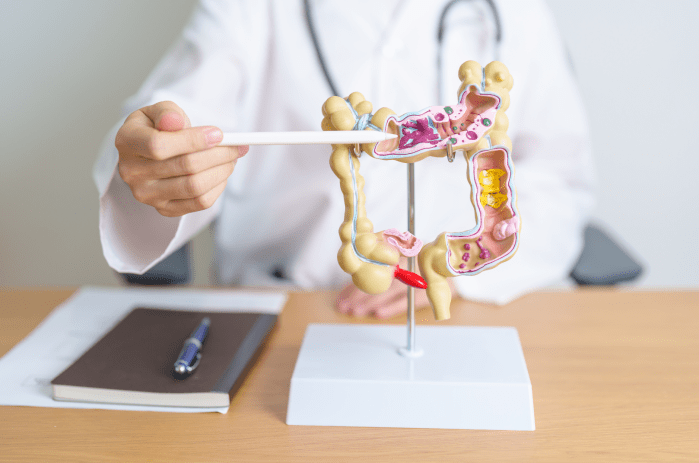 Exámenes de detección del cáncer de colon para una vida más duradera y saludable